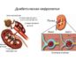 Нефропатия почек симптомы лечение