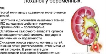 Расширение лоханки почек при беременности