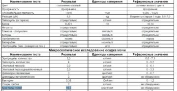 Обнаружена соль в моче у ребенка