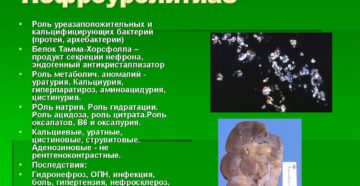 Нефроуролитиаз что это