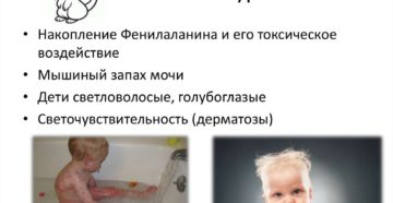 От ребенка мышиный запах