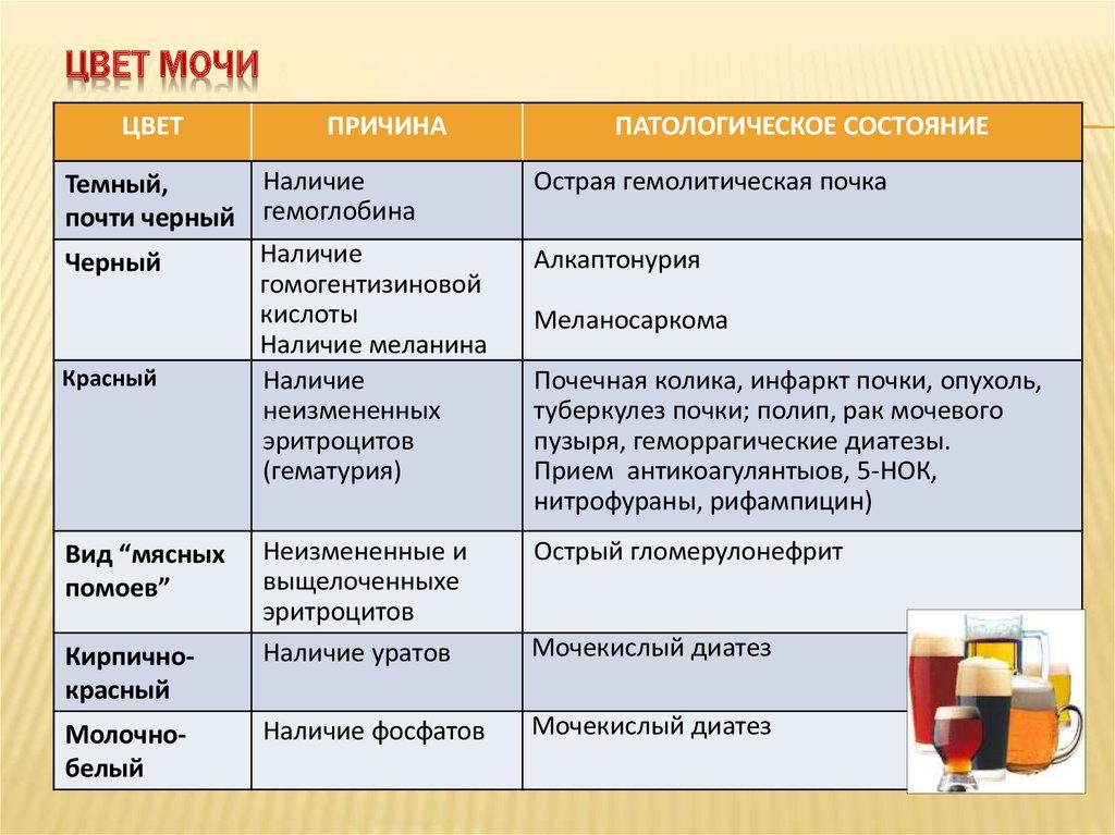 Светлая моча при каких заболеваниях почек