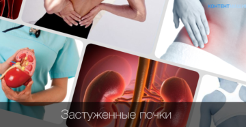 Если застужены почки