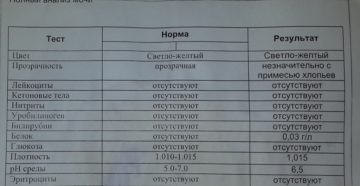 Анализ мочи с похмелья
