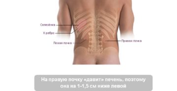 Правая почка выше чем левая