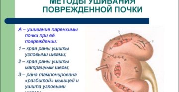 Что если отбил почку