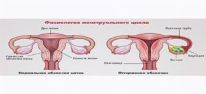 Почему перед месячными заболеваю