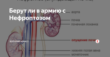 Нефроптоз берут ли в армию
