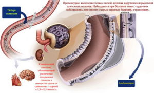 Много белка в моче у беременной