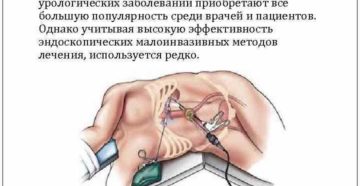 Питание после операции на почки и мочеточник