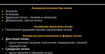 Аномальное развитие почек