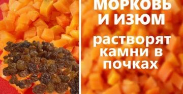 Выводим камни из почек народными средствами в домашних условиях