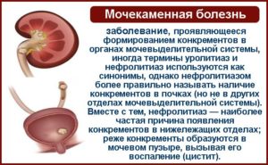 Цистит и мочекаменная