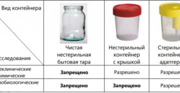 Какое количество мочи достаточно для анализа