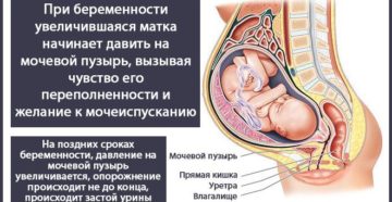 При беременности болит мочевой что делать