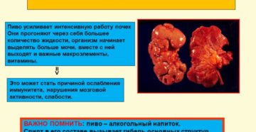 Вредно ли пить много воды при больных почках