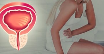 Ложные позывы к мочеиспусканию у детей без боли