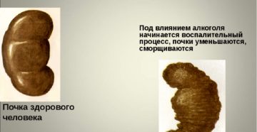 Почки пьющего человека