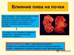 Можно ли при мочекаменной болезни употреблять алкоголь