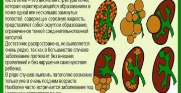 Лекарства при кисте почки