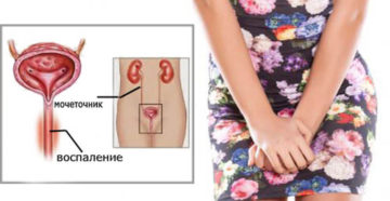 Уретрит симптомы у девочек