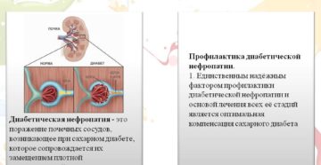 Осложнения на почки при сахарном диабете 2 типа