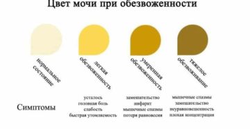 Какая моча при беременности