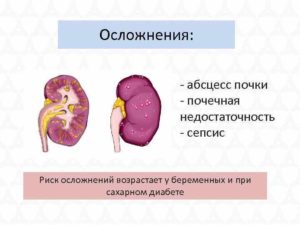 Абсцесс почки при сахарном диабете