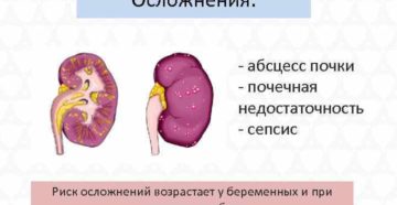 Абсцесс почки при сахарном диабете