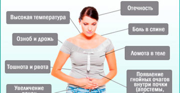 Боли в почках при всд