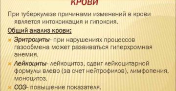 Общий анализ мочи при туберкулезе