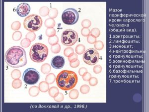 В мазке лейкоциты и эритроциты