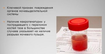 От чего красная моча у женщин