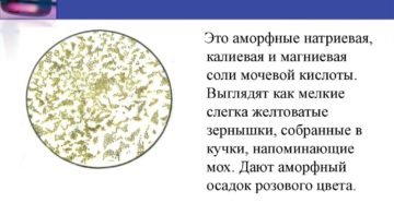 Ураты в моче в большом количестве что делать
