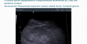 Гиперэхогенное образование в почке 4 мм