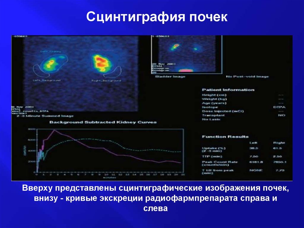 Сцинтиграфия почек противопоказания