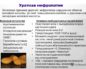 Карбонатапатит в почках причины