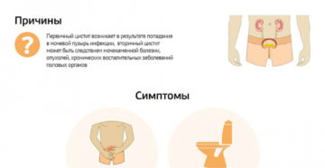 Что такое цистит и как проявляется