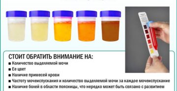 Моча при заболевании почек