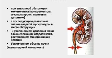 Приступ почек симптомы