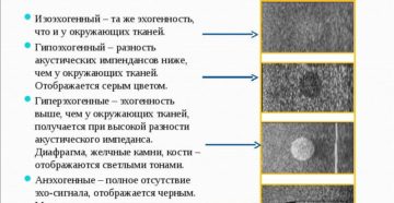 Эхогенное образование что это такое