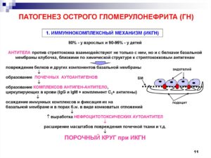 Патогенез протеинурии и гематурии при остром гломерулонефрите