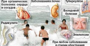 Можно ли купаться в море с больными почками