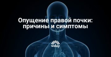 Опущение правой почки последствия