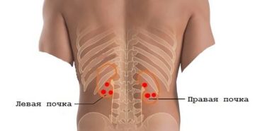 Где расположена правая почка у человека