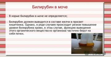Билирубин в моче у ребенка