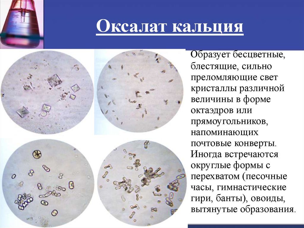 Что такое оксалаты