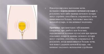 Краснодар недержание мочи
