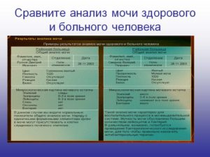 Анализ мочи при больных почках