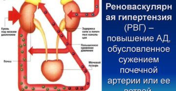 Почечная давление признаки